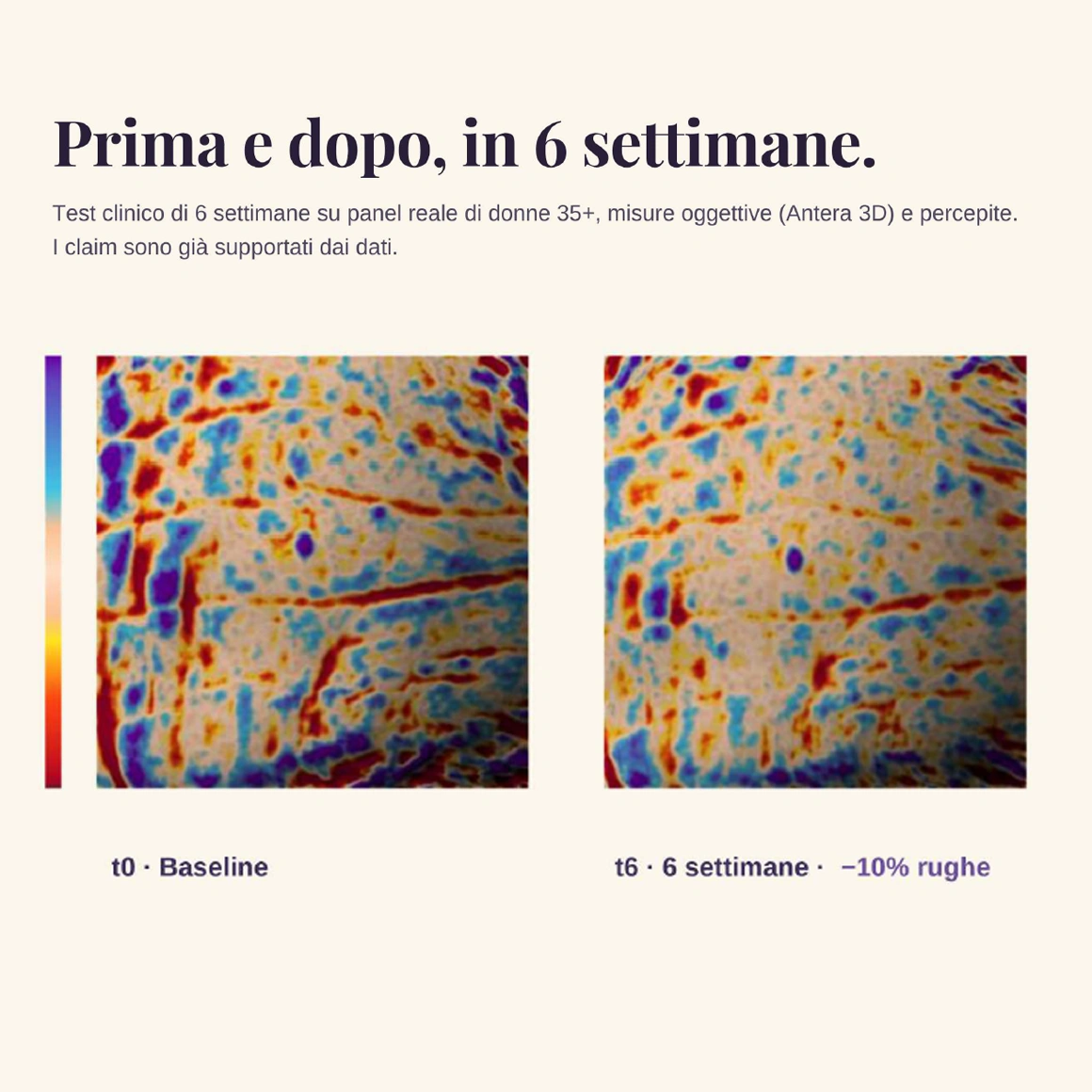 Huva – Immagine 1